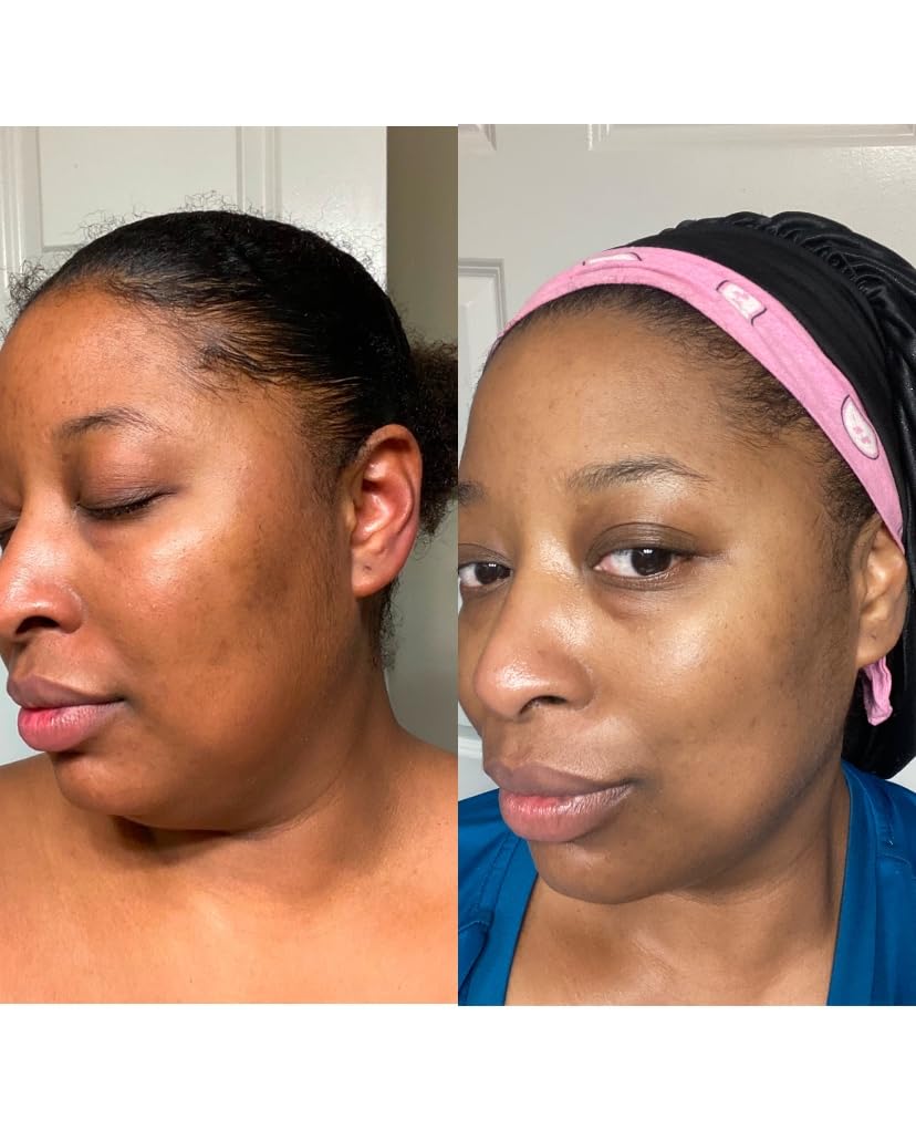 Black Girl Sunscreen | SPF 30 Moisturizing Face & Body Lotion, No White Cast — 2 fl oz - mildlymama